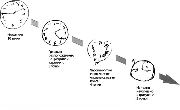 Тестът с циферблата сканира за деменция и Алцхаймер