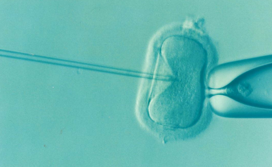 Бебе на безплодна онкоболна се роди от замразена яйцеклетка